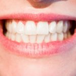Ładne nienaganne zęby także powalający prześliczny uśmieszek to powód do zadowolenia.